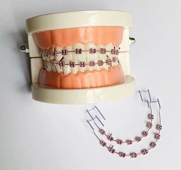 Fake Traces For Teeth Temporary False Fake Brackets Metal Wires Metal Bracket